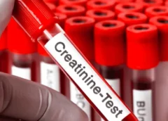 Creatinine Clearance