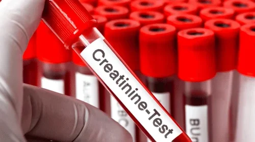 Creatinine Clearance