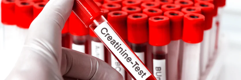 Creatinine Clearance