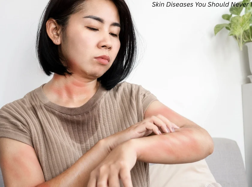 Rare Skin Diseases