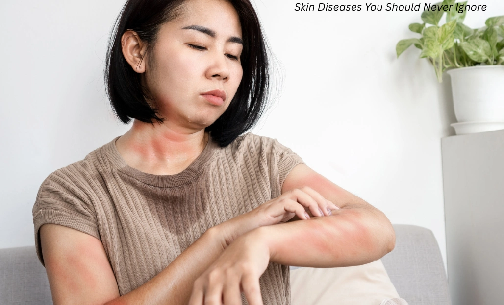 Rare Skin Diseases